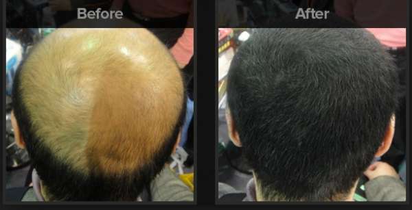 Advanced Hair Studio - Delhi