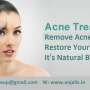 Skin Treatments for Every Skin type by Anjali's Women Salon